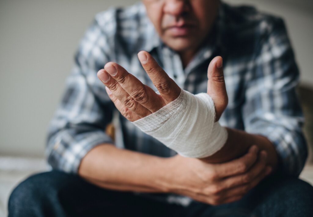 Photo of a Man with an Injured Hand
